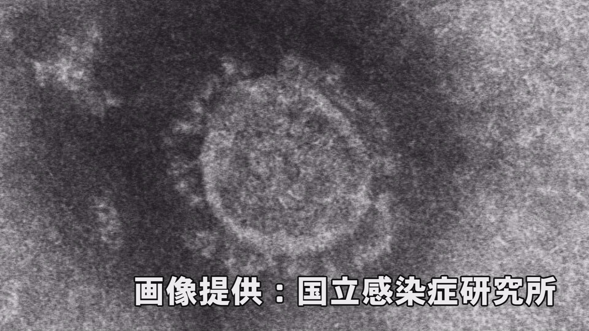 新型コロナ 上越市で3人感染確認  パート従業員60代女性、無職70代男性、会社員20代男性
