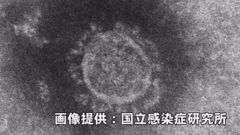 新型コロナ 上越市で9人、妙高市で2人の感染確認  県内全体は115人