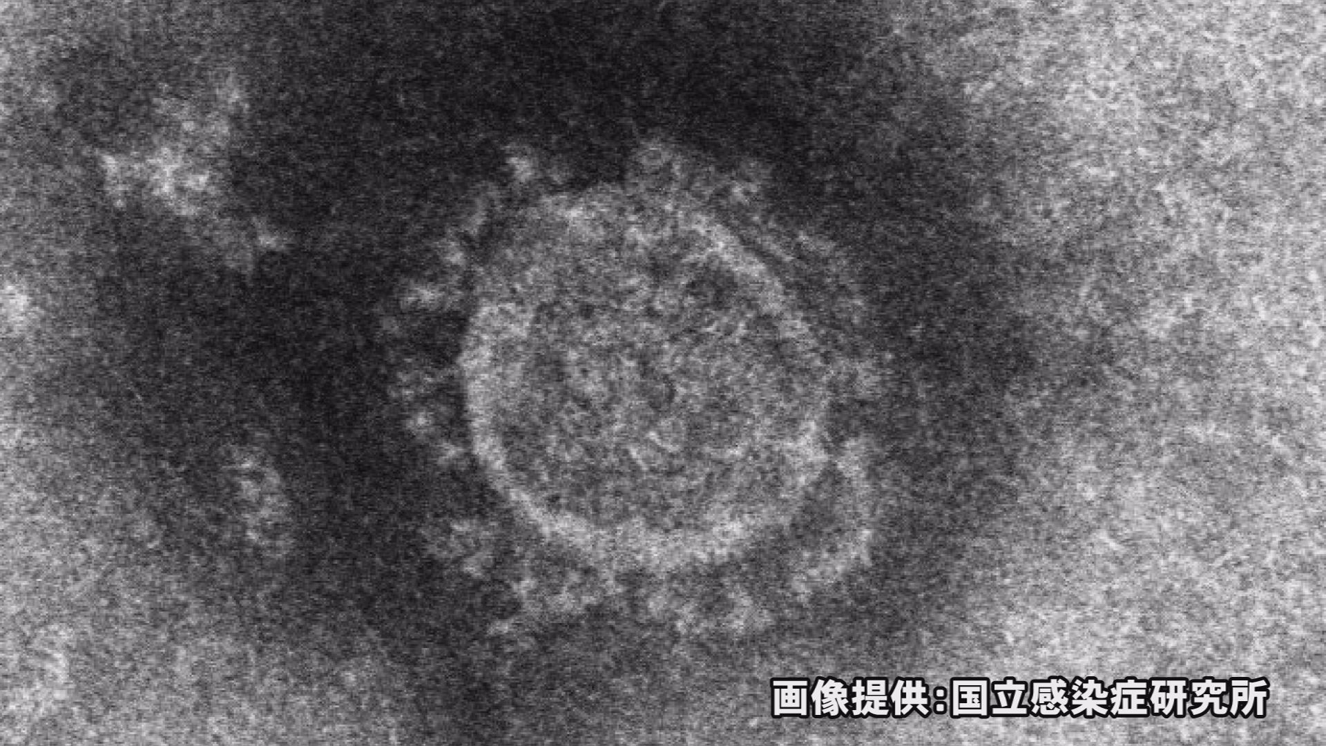 新型コロナ 上越市で新たに3人感染確認 県内全体は127人