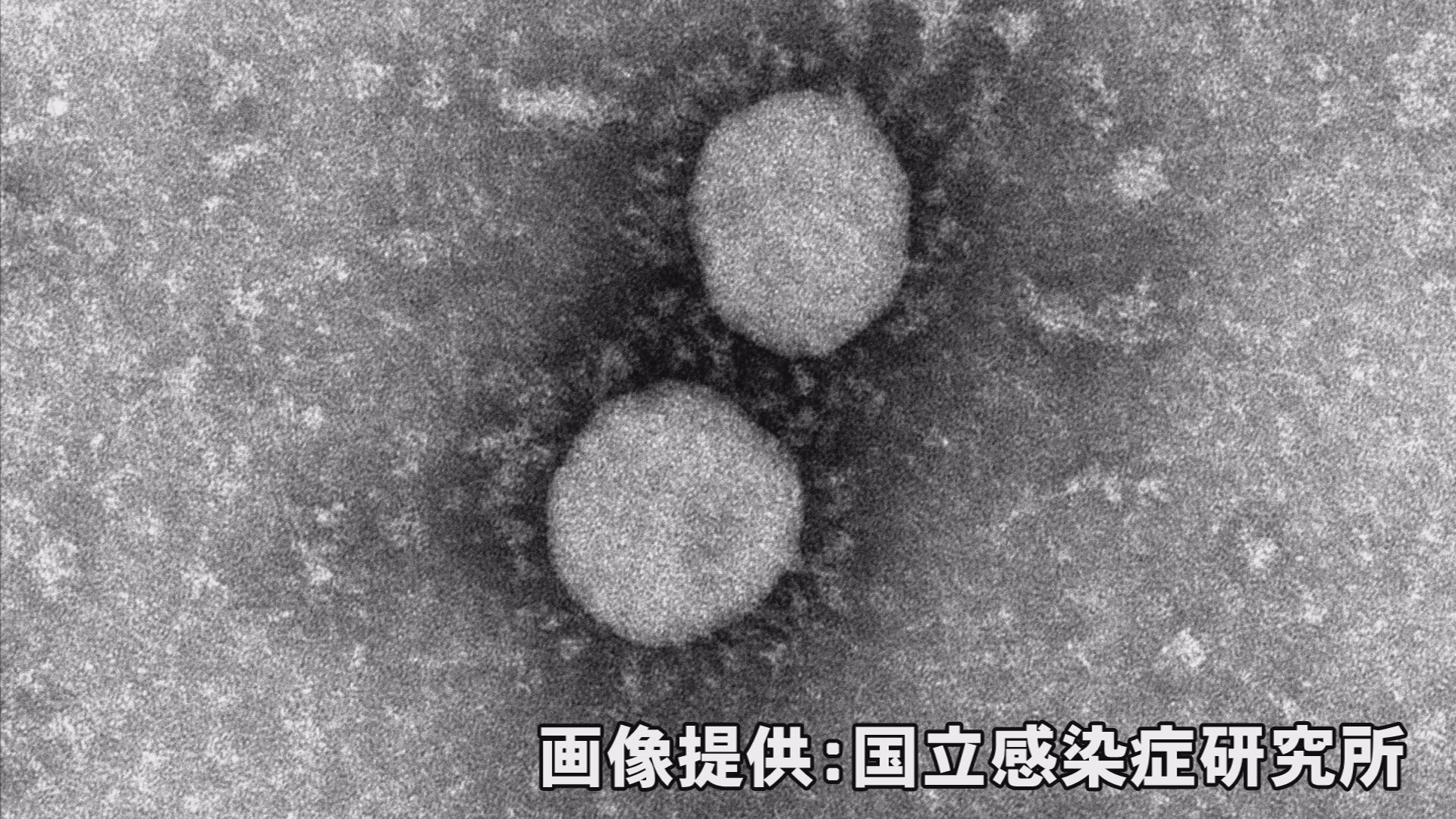 新型コロナ10日（月）新たに上越市4人 県内全体76人の感染確認